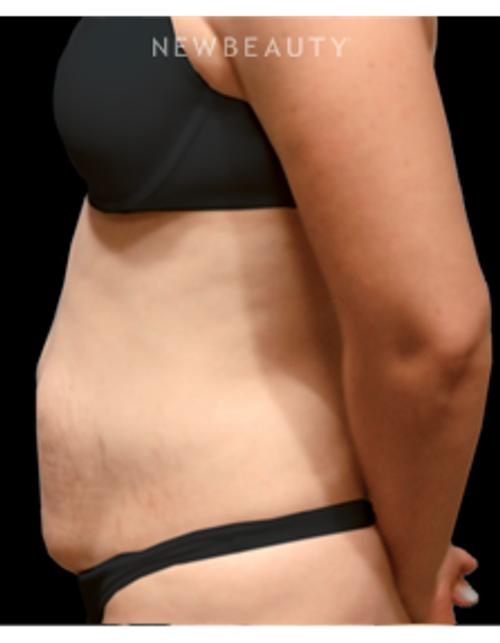 Dr. Bryan W. Gawley - Sculpted Silhouette - Before