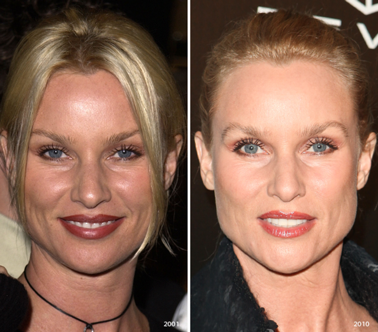 Nicollette Sheridan's