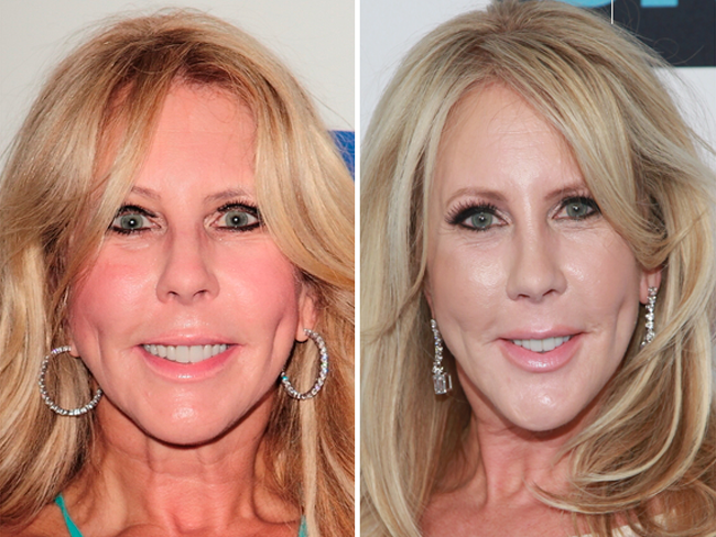 vivki Main Newbeauty