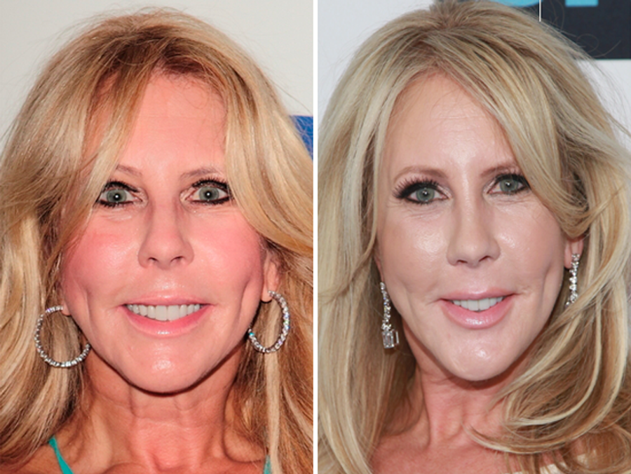 vivki Main Newbeauty