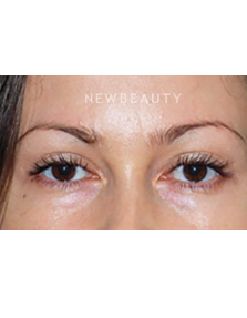 Dr. Roman Rayham - Through New Eyes - After