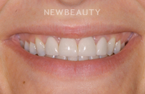 Dr. Salvator J. La Mastra - Transformative Upgrade - 44409698 - Before
