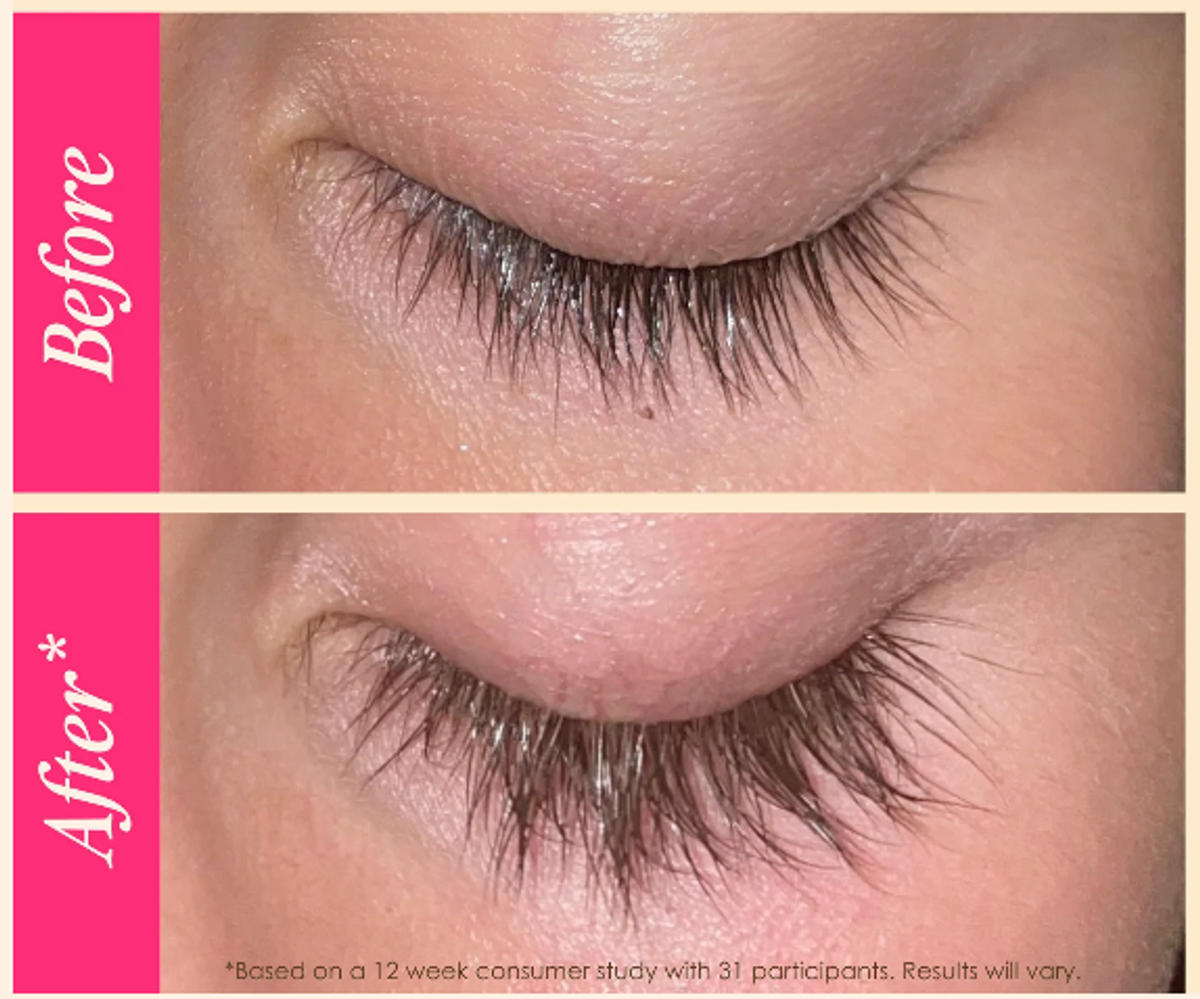 A before-and-after image using Grande Cosmetics GrandeLASH-Sensitive 