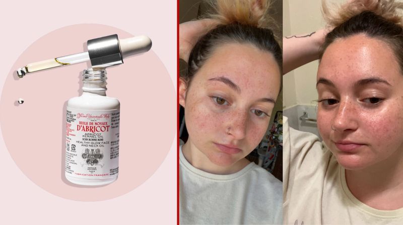 This French Face Oil Totally Transformed My Skin
