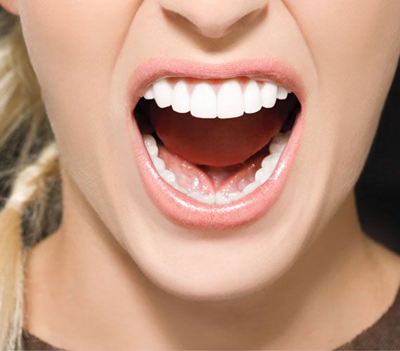 Poor-Fitting Crowns and Veneers