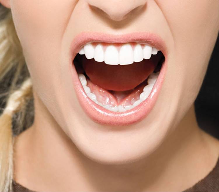 Poor-Fitting Crowns and Veneers
