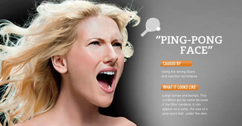 When Beauty Backfires Ping Pong BATCH12 920 Main