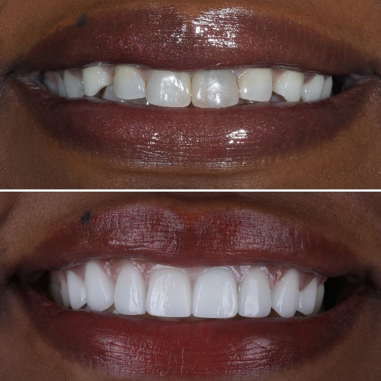 Essential Upgrade for an Essential Worker