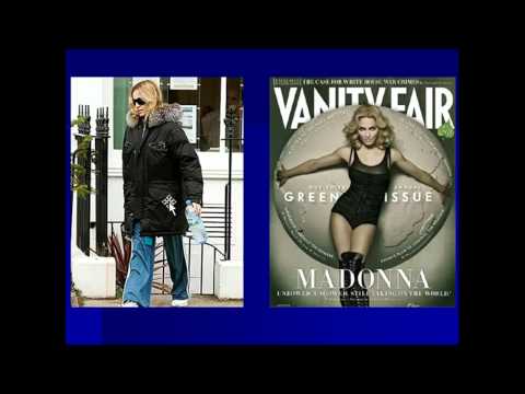 Dr. David Kim – Rhinoplasty – The Structural Approach To Rhinoplasty – Part 2