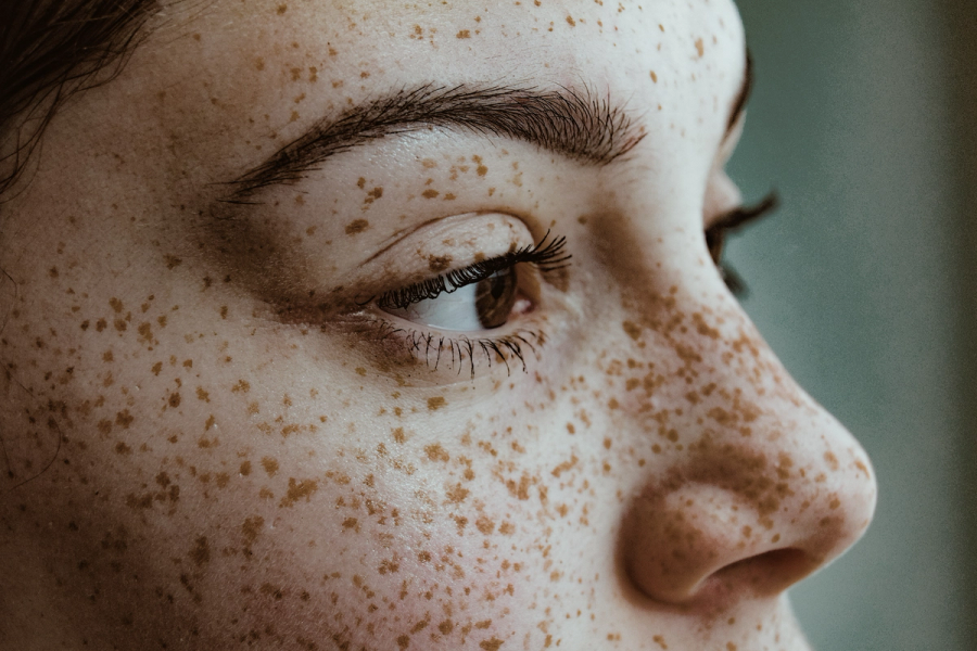This Skin-Care Product Is Proven to Brighten Skin Better Than Hydroquinone