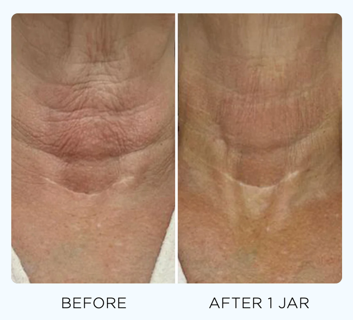 gopure neck cream before and after