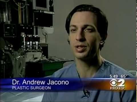 Dr. Jacono – Revision Rhinoplasty Surgery