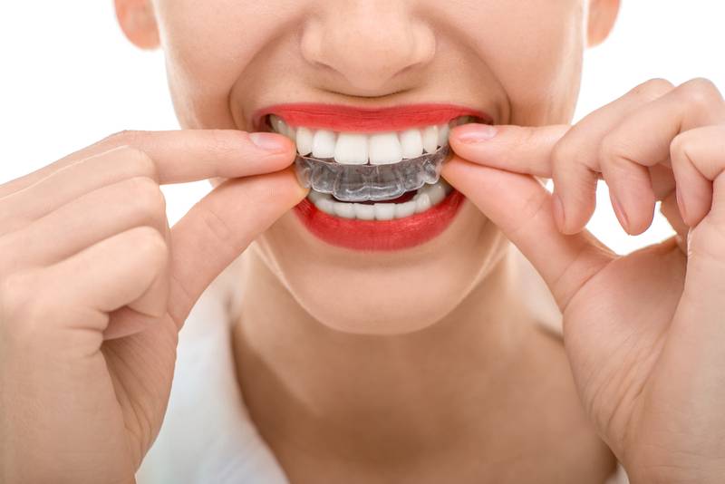 TeethShift