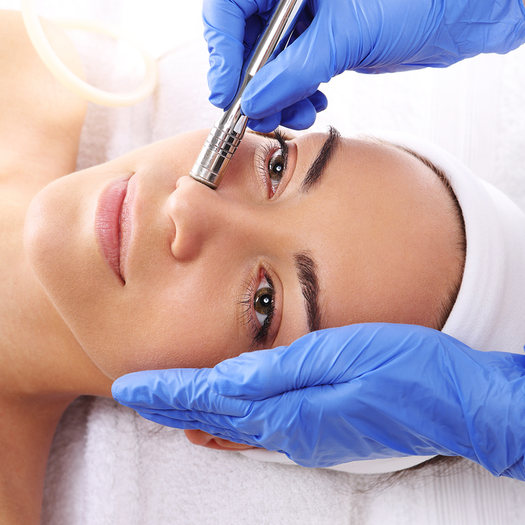 microdermabrasion