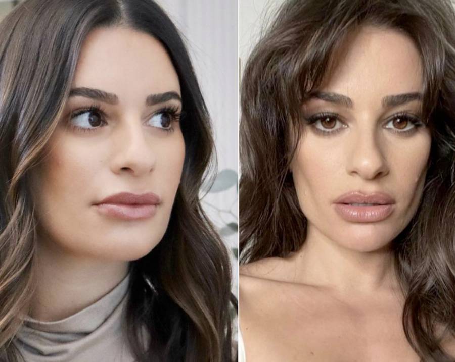 Why Everyone Is Talking About Buccal Fat Removal Again