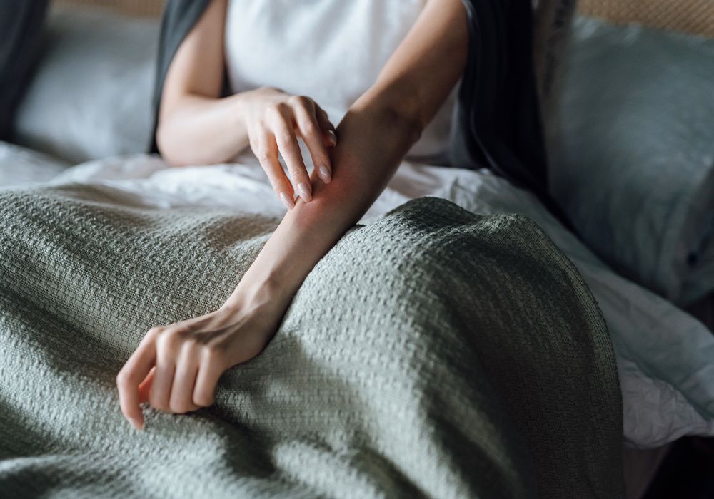 What Skin Experts Want You to Know About the Monkeypox Rash and Scarring