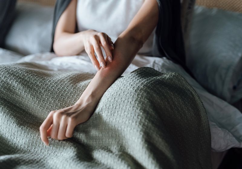 What Skin Experts Want You to Know About the Monkeypox Rash and Scarring