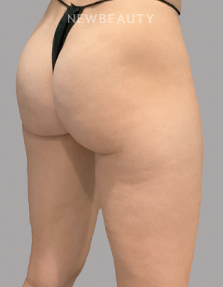 Dr. Janet Allenby -  Smooth Moves - 24004988 - After