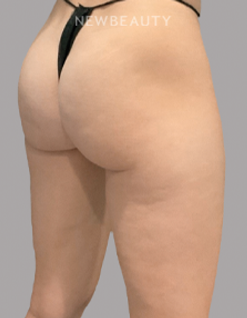 Dr. Janet Allenby -  Smooth Moves - 24004988 - After