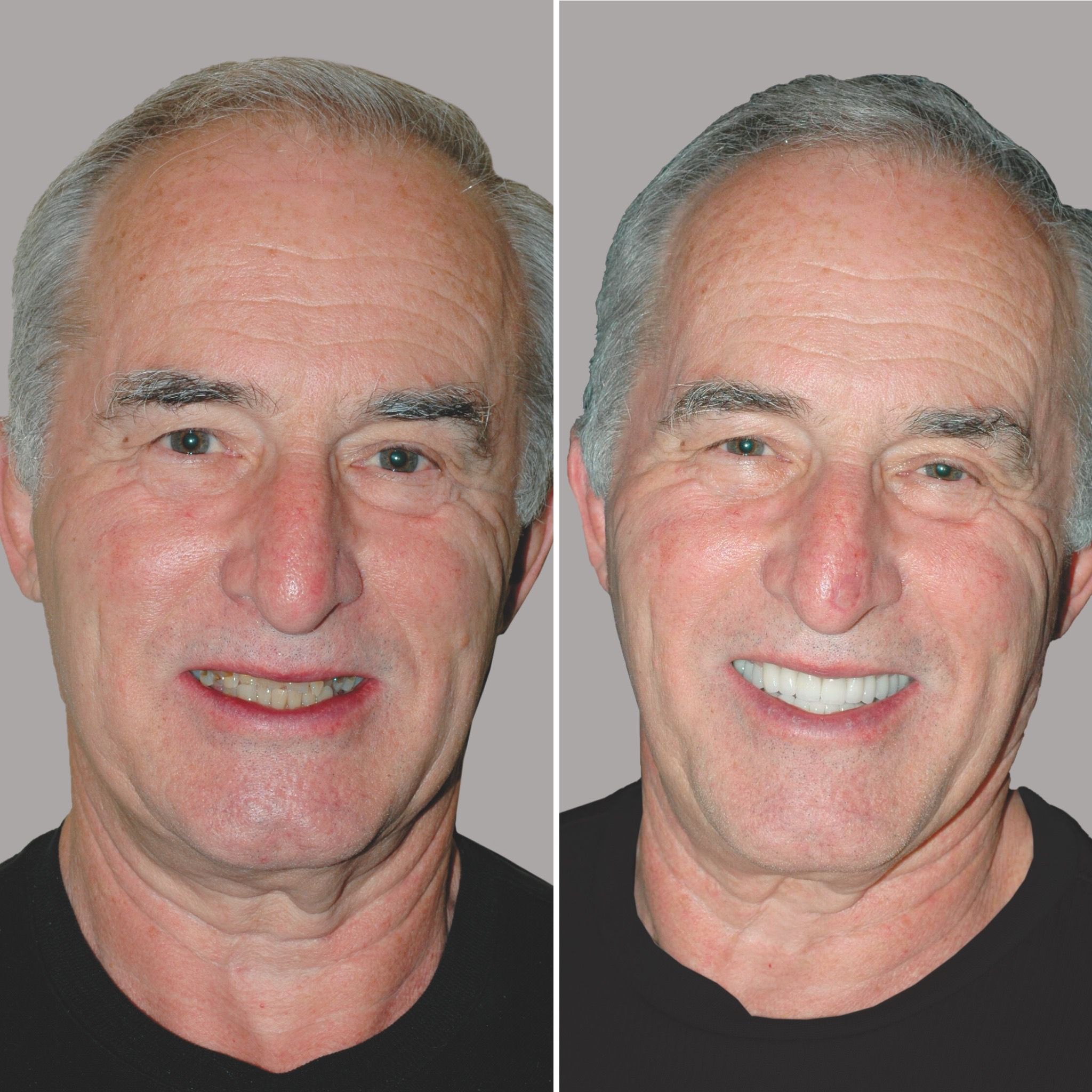 The Ultimate Anti-Ager