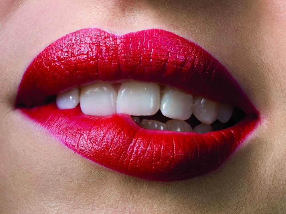 All the Reasons Why Veneers Are Having a Major Moment