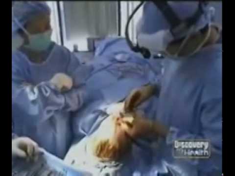 Dr. David Kim – Dr. David W. Kim, San Francisco Facial Plastic Surgeon, On Discovery Channel