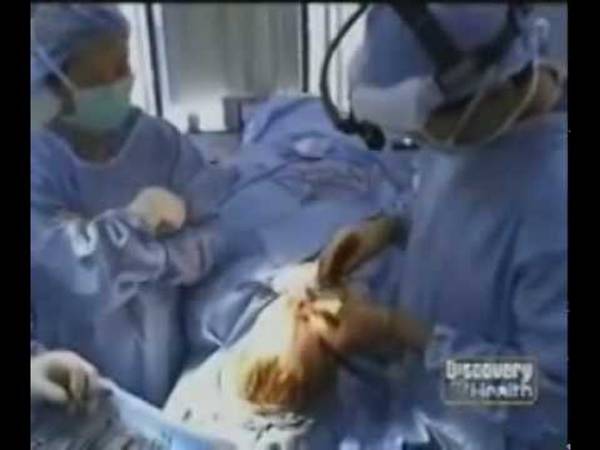 Dr. David Kim – Dr. David W. Kim, San Francisco Facial Plastic Surgeon, On Discovery Channel
