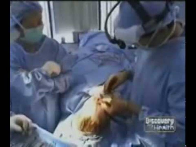 Dr. David Kim – Dr. David W. Kim, San Francisco Facial Plastic Surgeon, On Discovery Channel