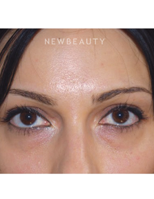 Dr. Roman Rayham - Beautiful Results - Before