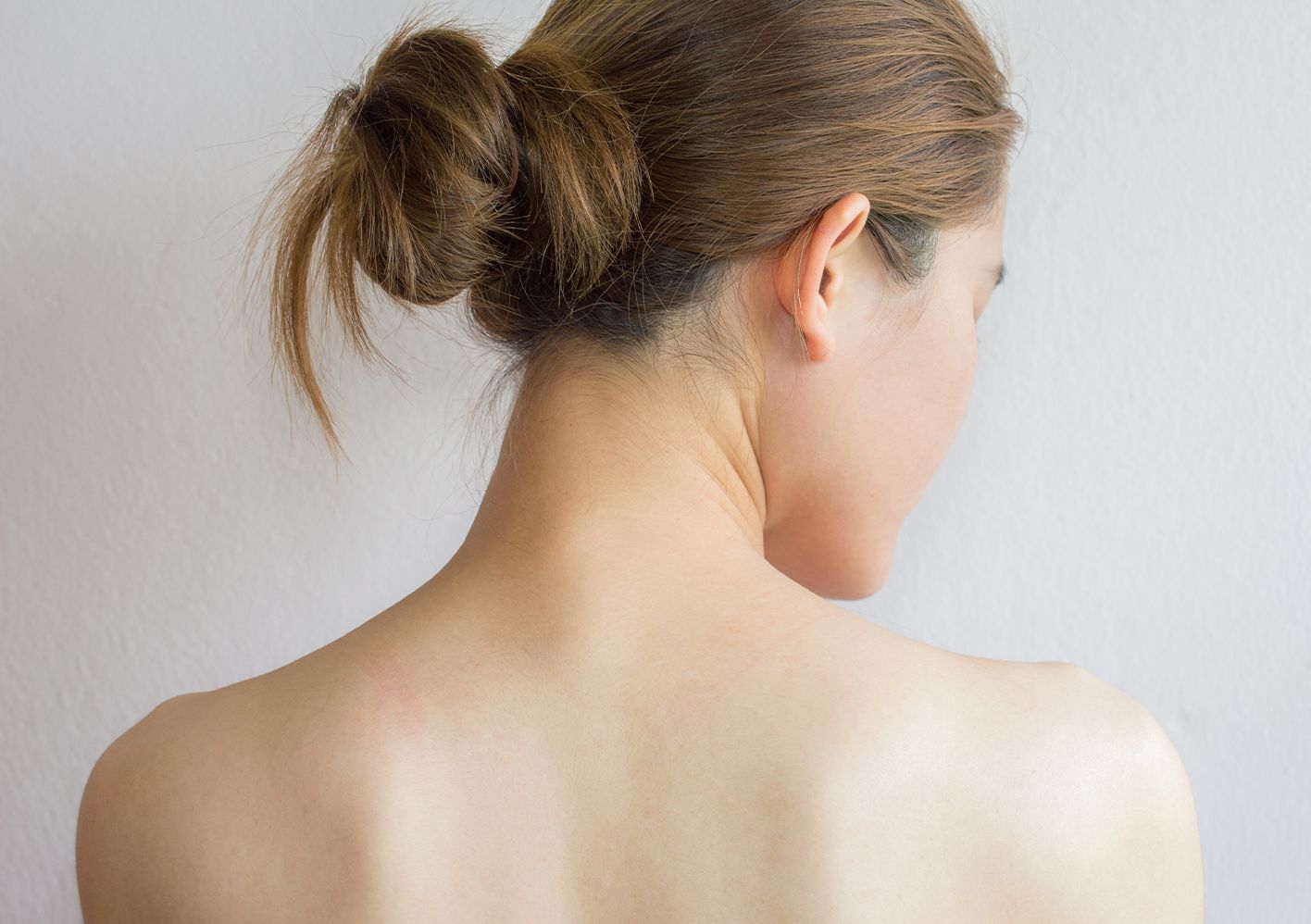 Trapezius Botox: Pros and Cons of the Trending “Trap Tox”