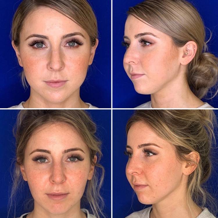 New York facial plastic surgeon Dilip Madnani, MD
