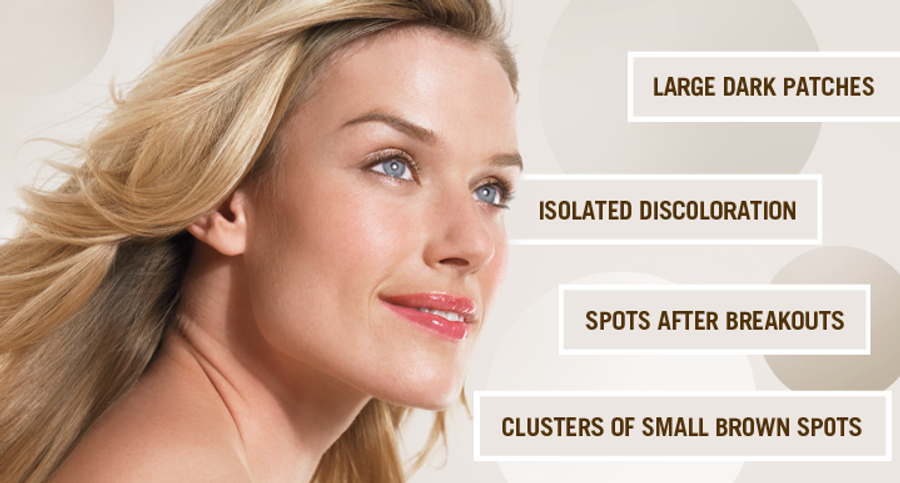 stop Spots Newbeauty