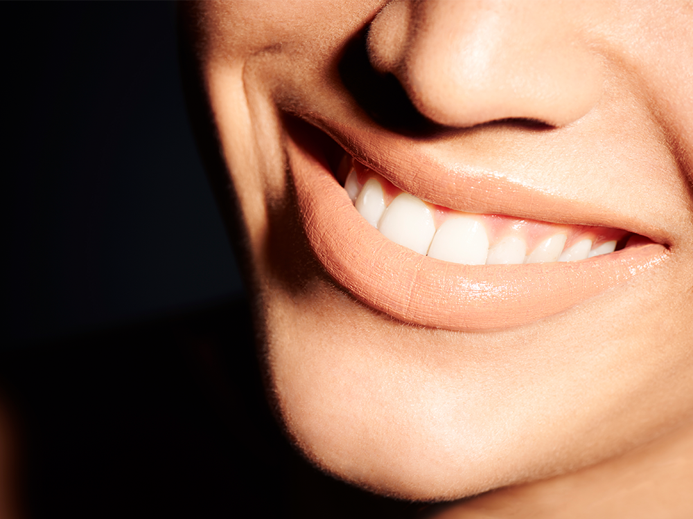 Smile recontouring