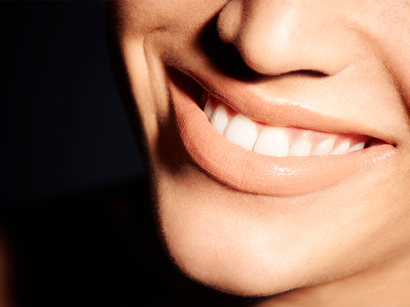 Say Goodbye to Stains With This Cosmetic Dentist’s Innovative Approach to Crowns and Veneers