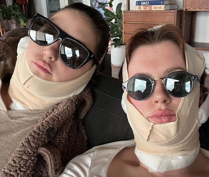 Ireland and Alaia Baldwin Reveal the Facial Procedures They Just Got Done