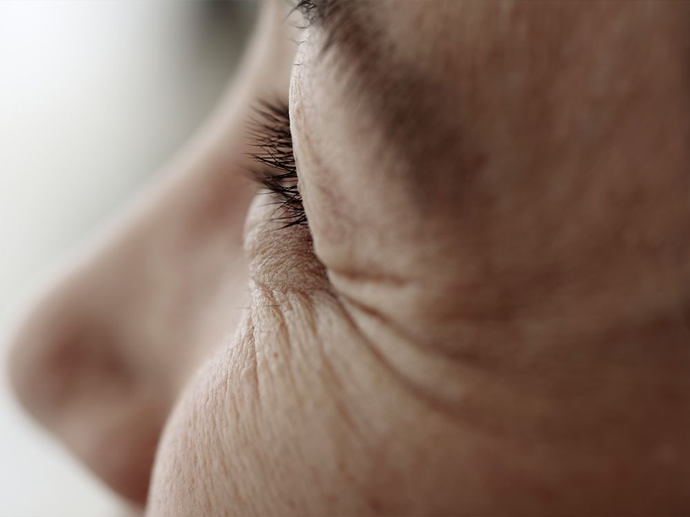 Botox Cosmetic at 40: Why I Waited Until Now and What It’s Really Like