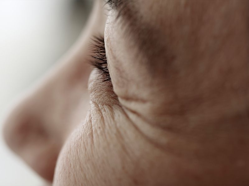 Botox Cosmetic at 40: Why I Waited Until Now and What It’s Really Like