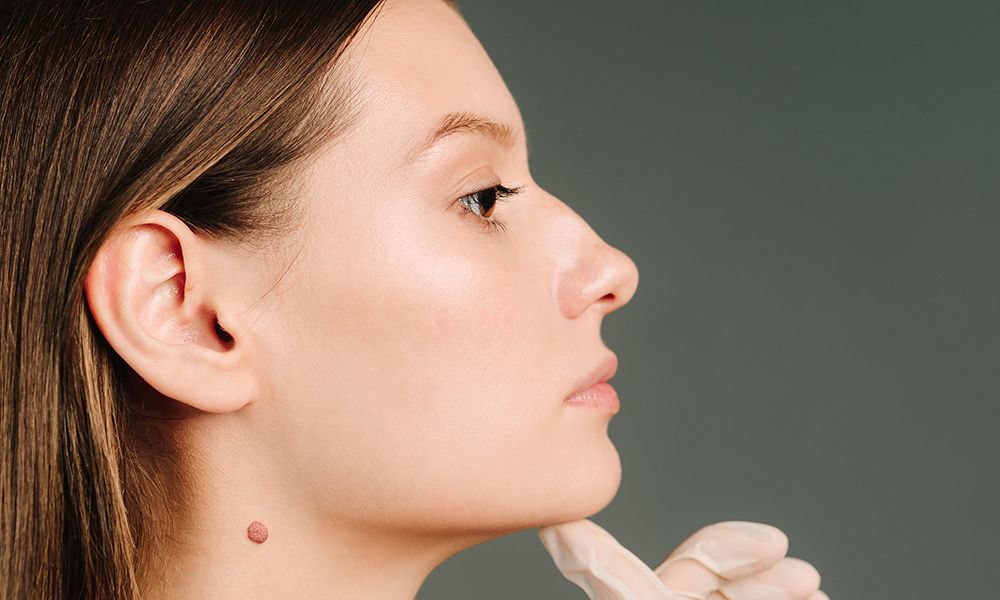 Doctor prepares women's skin for beautiful face contour. Contour plastic for correcting the shape of the face. Markup skin for beauty treatment