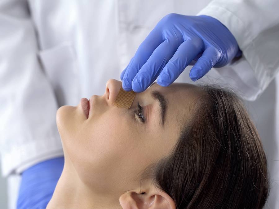 rhinoplasty