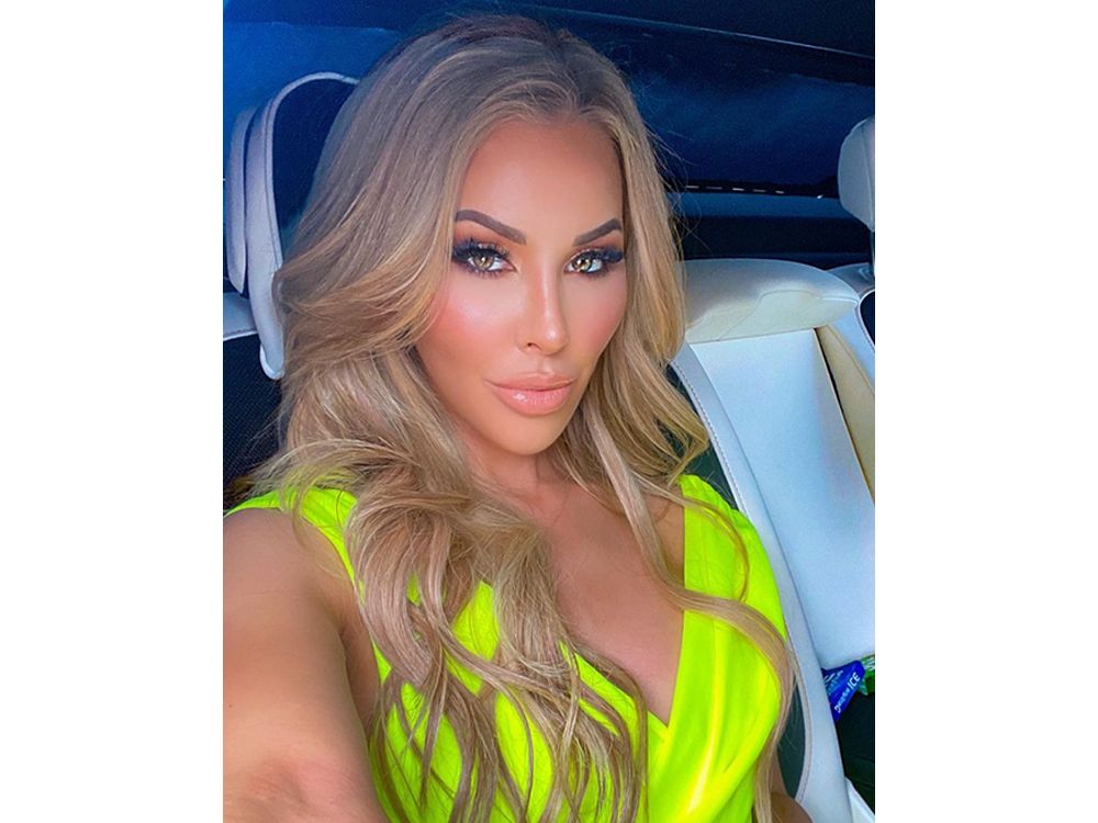 Why This ‘Real Housewives of Miami’ Star Says She’s Done with Fillers