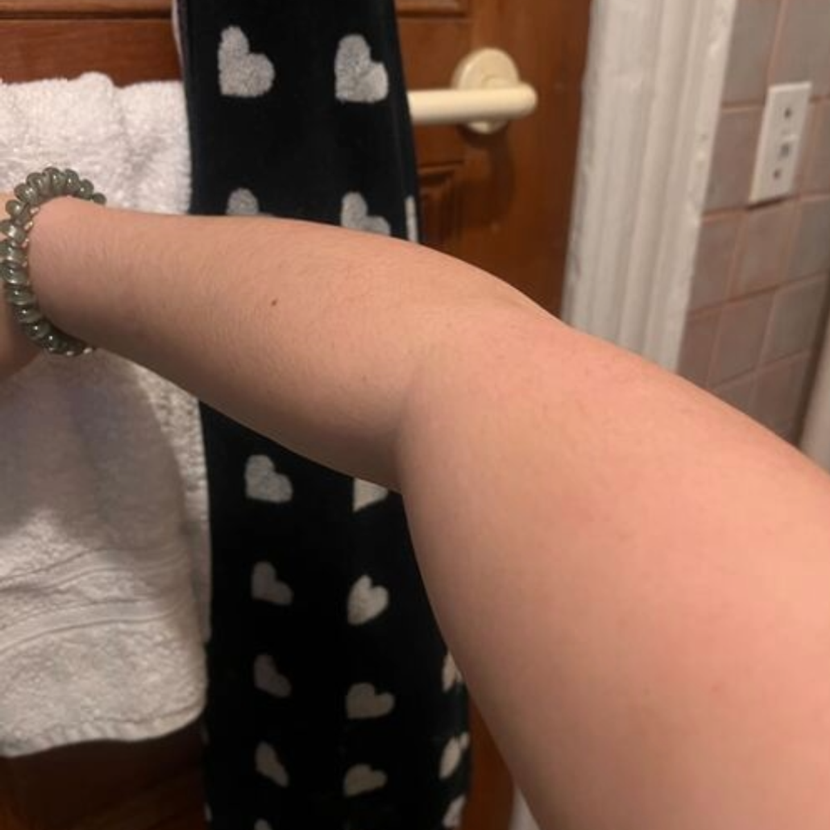 after saltyface on arm