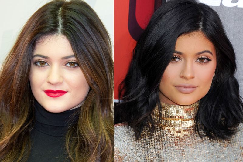 kylie B&A