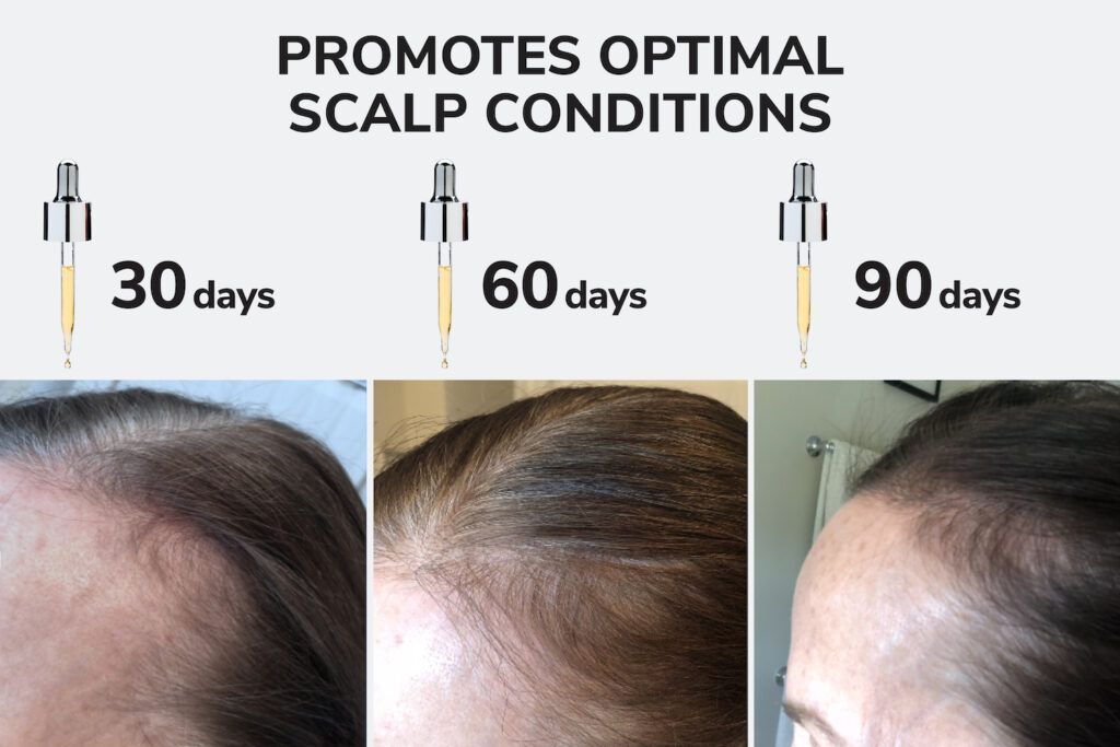 color-wow-youth-juice-scalp-treatment