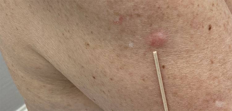 Slide 8