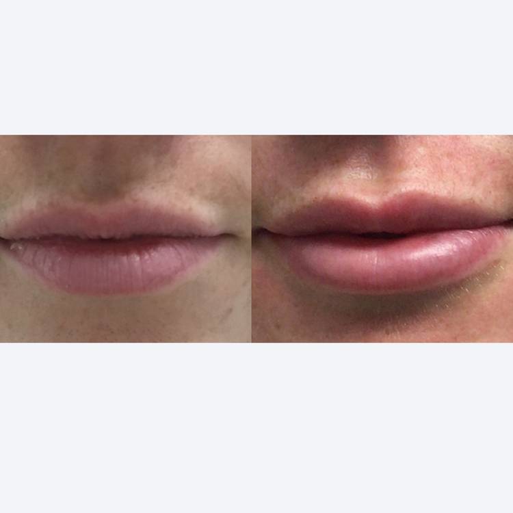 Slide 2