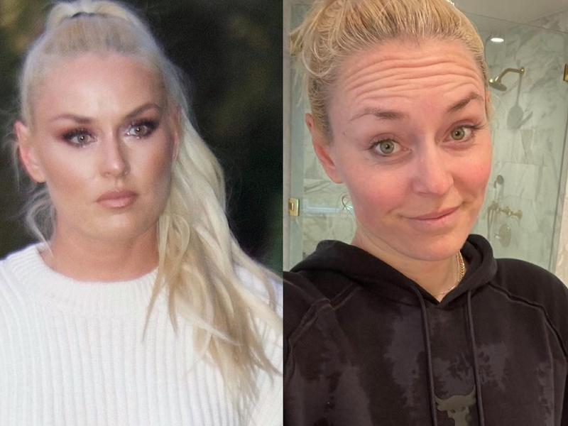 Lindsey Vonn’s No-Makeup Selfie Shows That Beauty Comes From Within