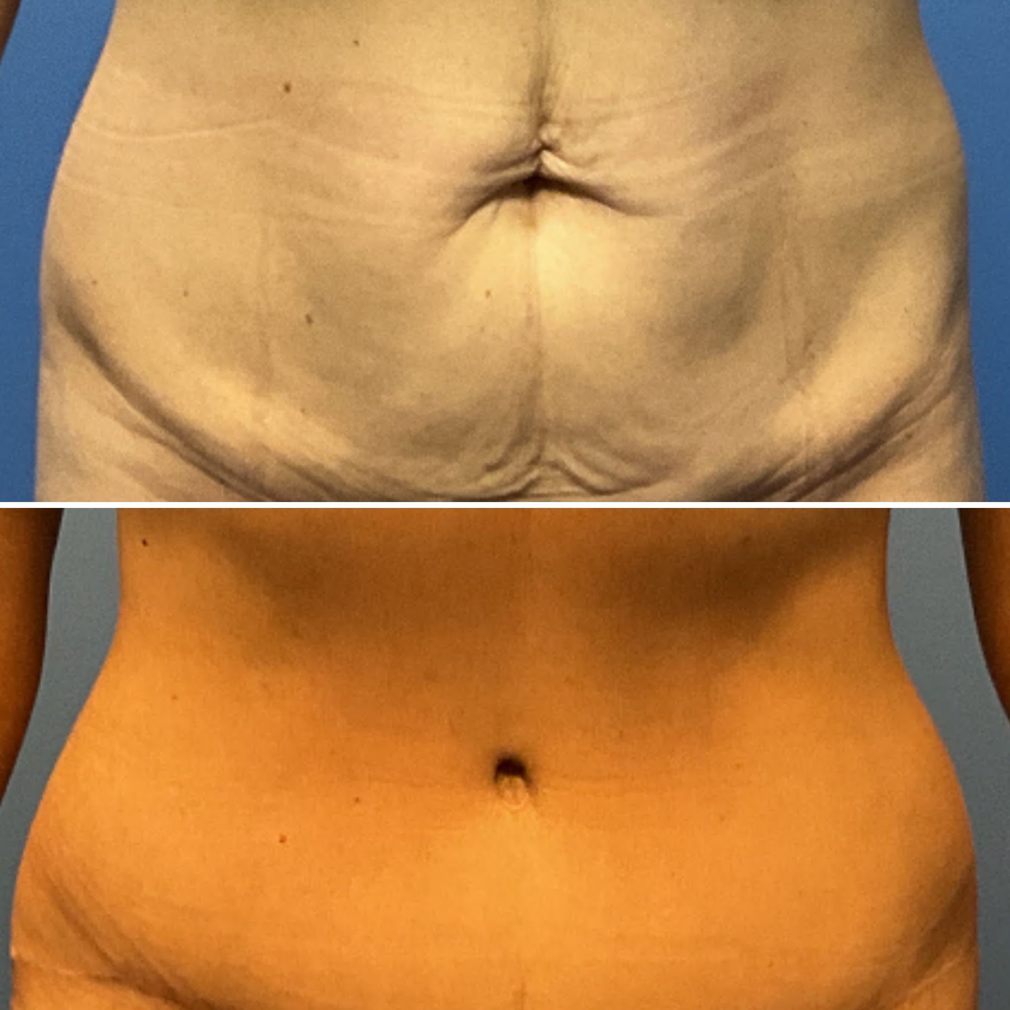 Denver, CO plastic surgeon Philippe Capraro, MD