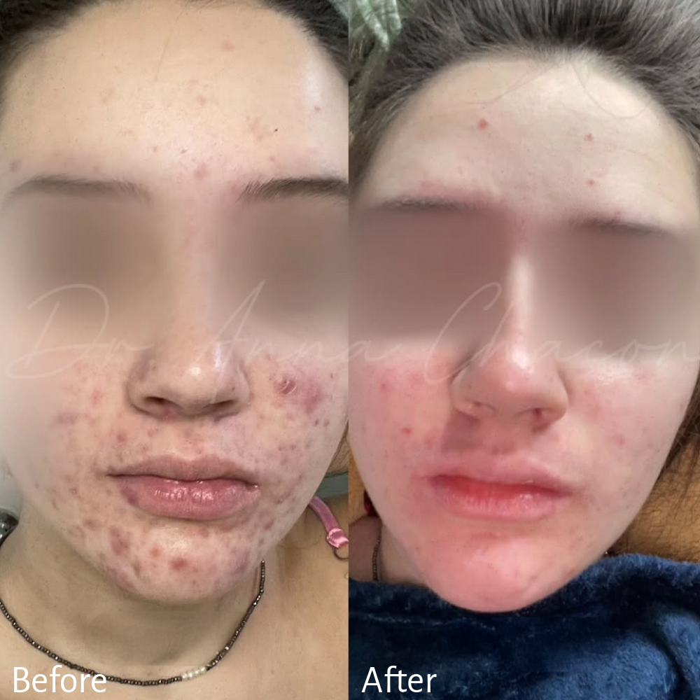 Dr. Anna Chacon personalized skin care routine