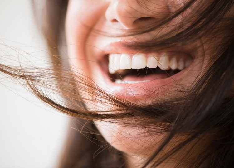 Using hydrogen peroxide to whiten teeth: 37.4 million views
