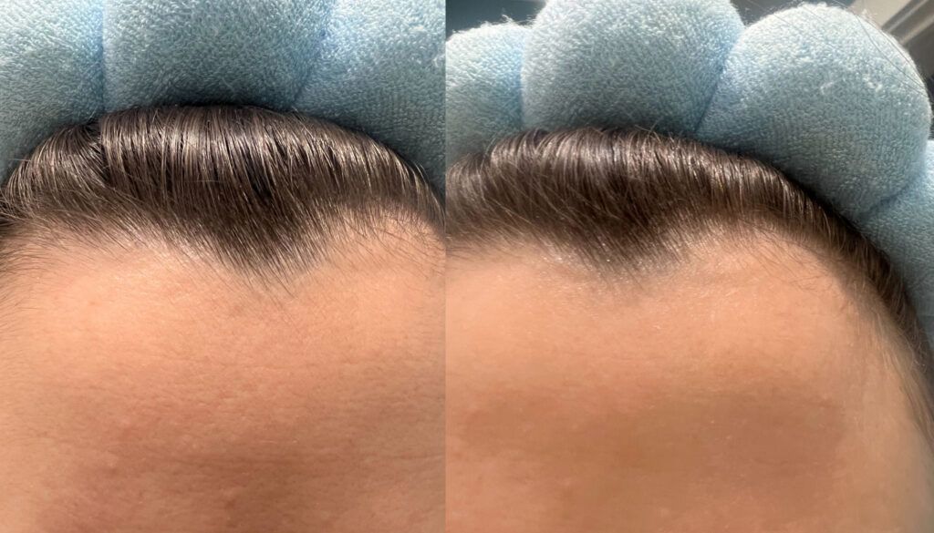 beautystat-before-and-after